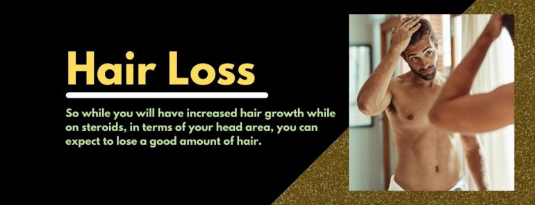 Hair Loss due to steroids